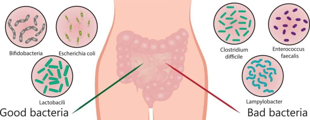 these are some common examples of good and bad bacteria found in the gut and intestines.